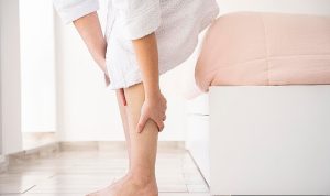 Yazın varis tedavisi olur mu?